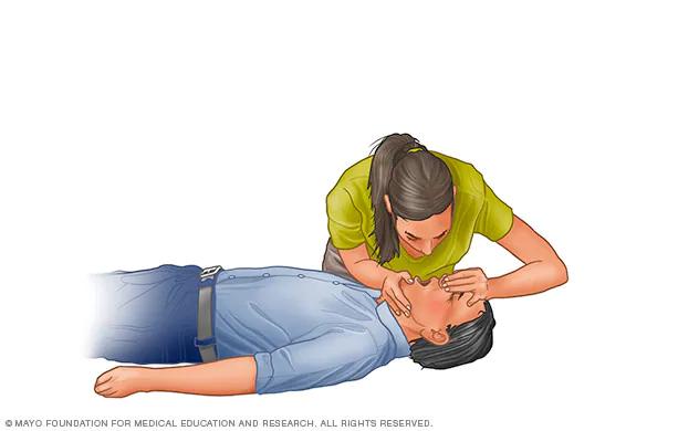 Ventilaciones de Rescate: Guía Completa para Salvar Vidas - Cómo hacer ventilaciones de rescate ventilaciones de rescate - Cómo hacer ventilaciones de rescate