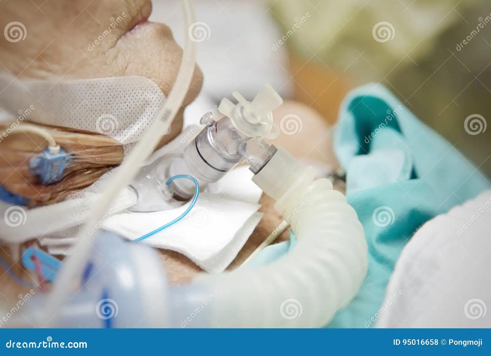 traqueostomia con ventilador - Cómo inhalar con traqueostomía