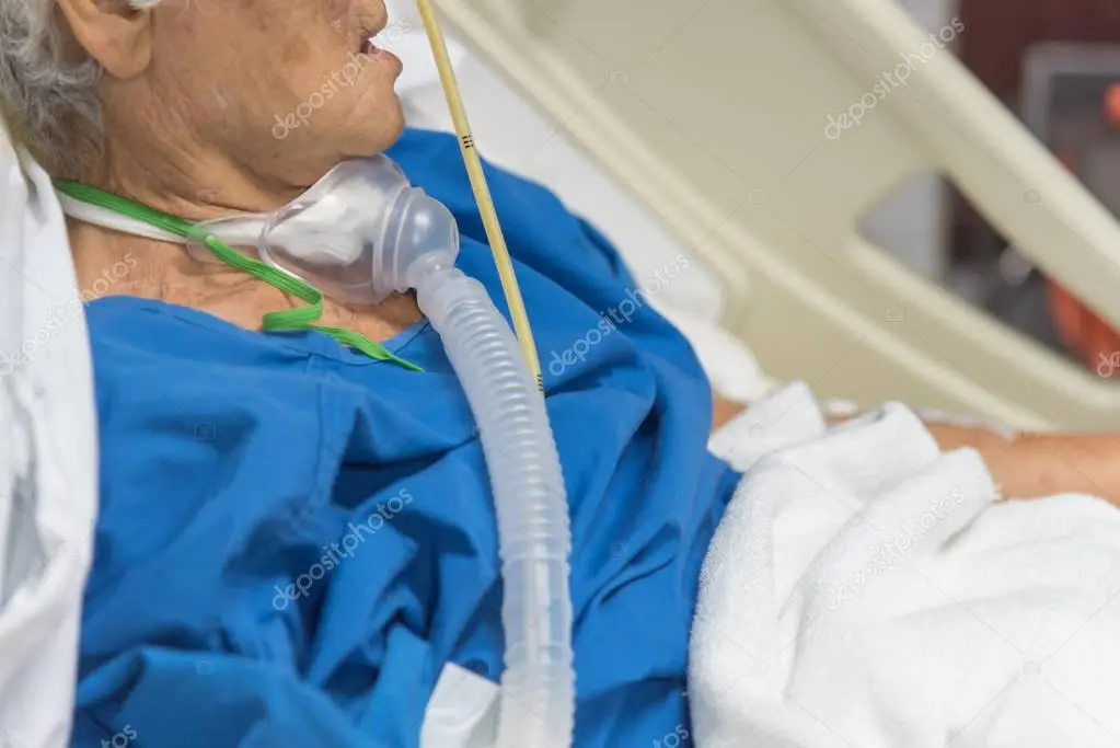 traqueostomia con ventilador - Cómo respira un paciente con traqueostomía
