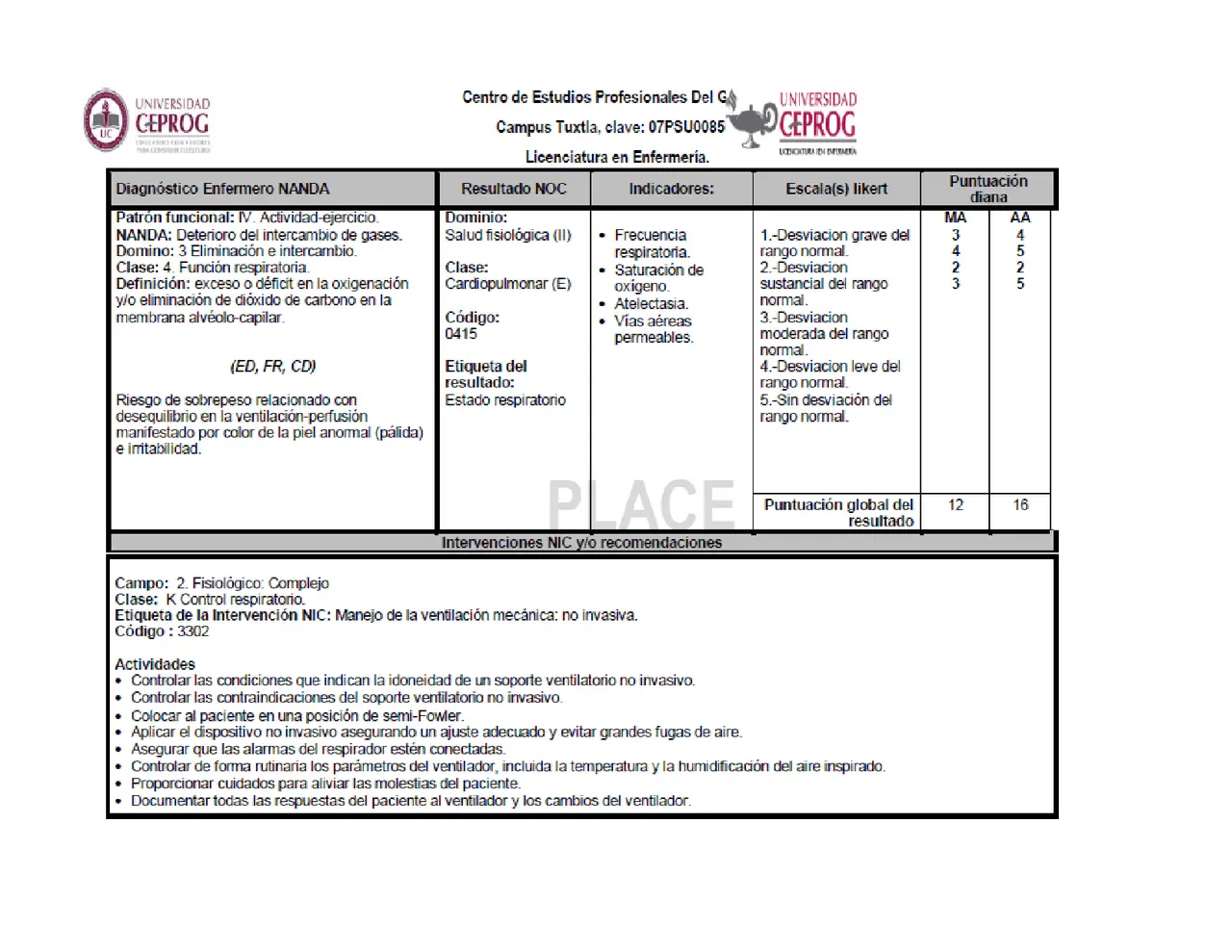 Ayuda a la Ventilación: Campos y Clases en el NIC - Cuáles son las clases en el NIC ayuda a la ventilación campo y clase en el nic - Cuáles son las clases en el NIC