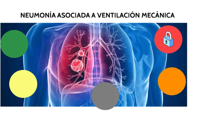 Neumonía No Ventilada: Una Guía Completa - Cuándo se considera grave una neumonía neumonia no ventilada - Cuándo se considera grave una neumonía