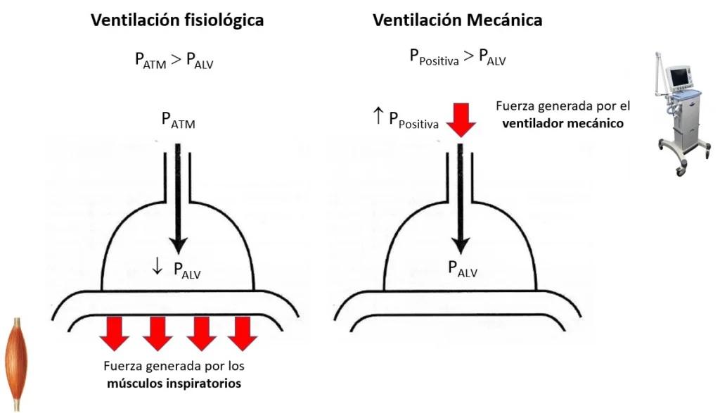 Ventilación Mecánica en el Accidente Cerebrovascular (ACV) - Cuando te da un derrame cerebral te Intuban ventilación mecanica y acv - Cuando te da un derrame cerebral te Intuban