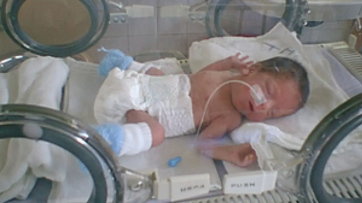 Ventilación Mecánica en Niños: Una Guía Completa - Cuánto tiempo debe estar un niño conectado a un ventilador ventilador mecanico en niños - Cuánto tiempo debe estar un niño conectado a un ventilador