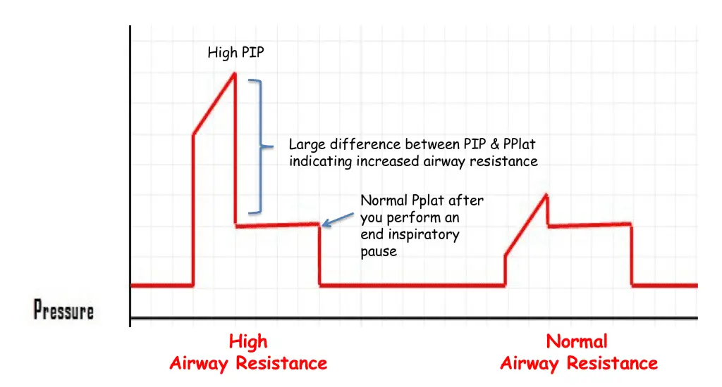 Resistencia de la Vía Aérea en la Ventilación Mecánica - How does airway resistance affect ventilation airway resistance mechanical ventilation - How does airway resistance affect ventilation