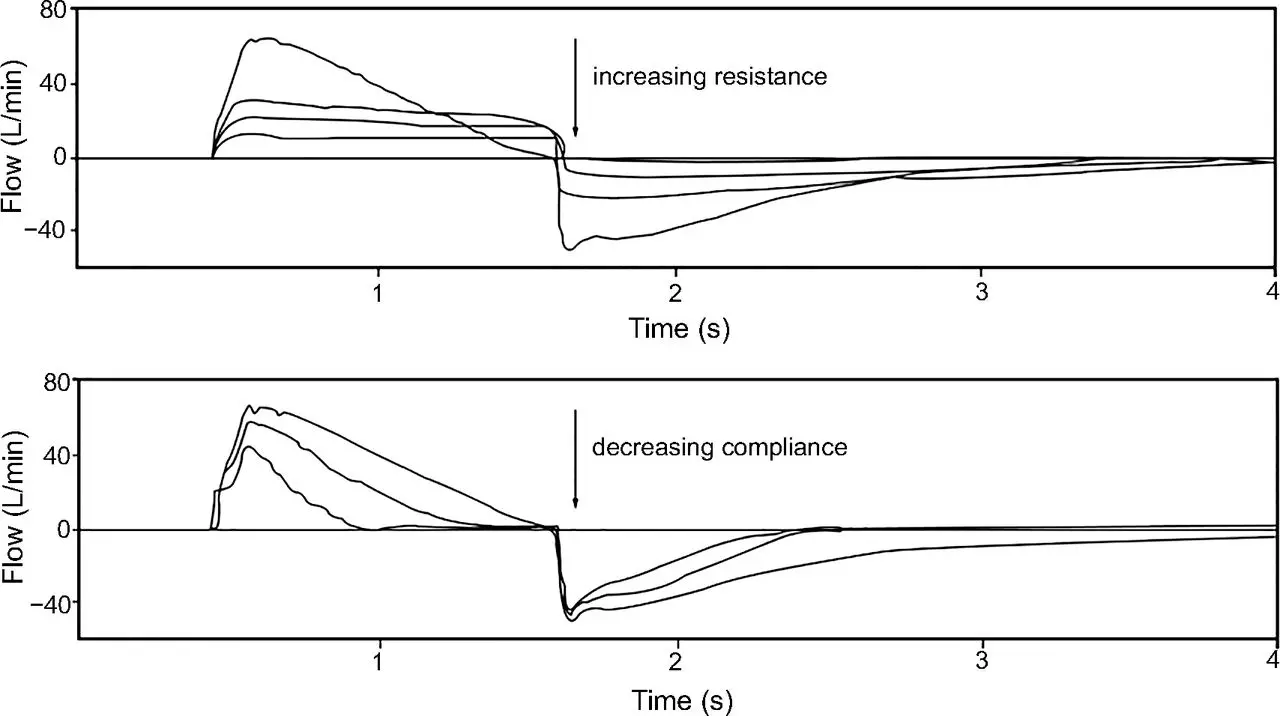 Gráficos del Ventilador de Branson: Una Guía Completa para la Interpretación - How has the advent of advanced graphics on our ventilators helped improve patient care and safety branson role of ventilator graphics - How has the advent of advanced graphics on our ventilators helped improve patient care and safety