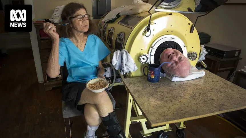 Pulmones de Acero: Historia, Funcionamiento y Legado - How long do you stay in an iron lung iron lung ventilator - How long do you stay in an iron lung