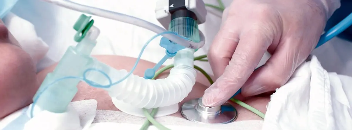 Traqueostomía en Pacientes Ventilados: ¿Para Qué la Hacemos? - Por qué la gente necesita traqueostomías traqueostomía en pacientes ventilados para qué la hacemos - Por qué la gente necesita traqueostomías