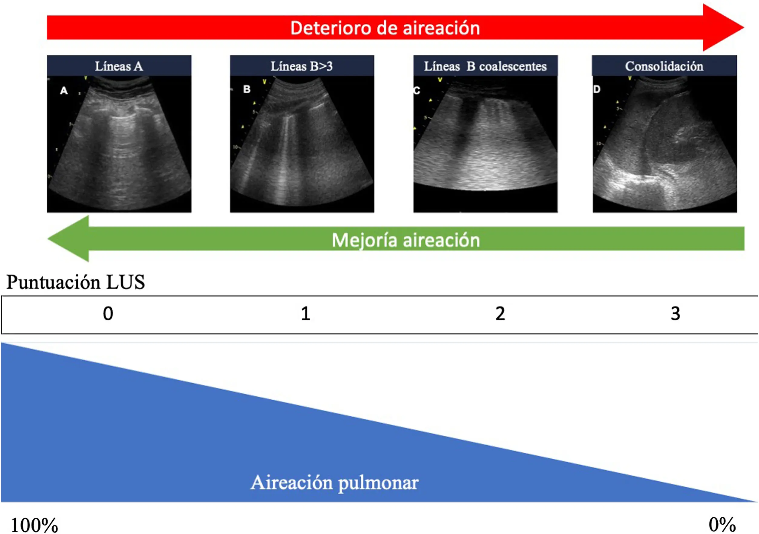 Campos Pulmonares Ventilados: Dx, Tx y Abreviaturas - Qué es Dx y Tx campos pulmonares ventilados abreviaturas - Qué es Dx y Tx