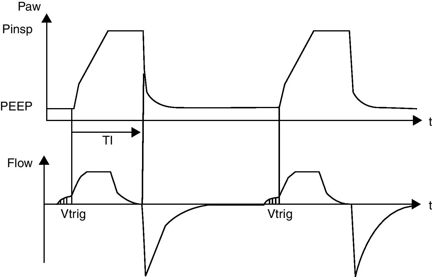 Alarmas del Ventilador Mecánico: Compresión y Manejo - Qué es el PIP en ventilación mecánica alarmas ventilador mecanico - Qué es el PIP en ventilación mecánica