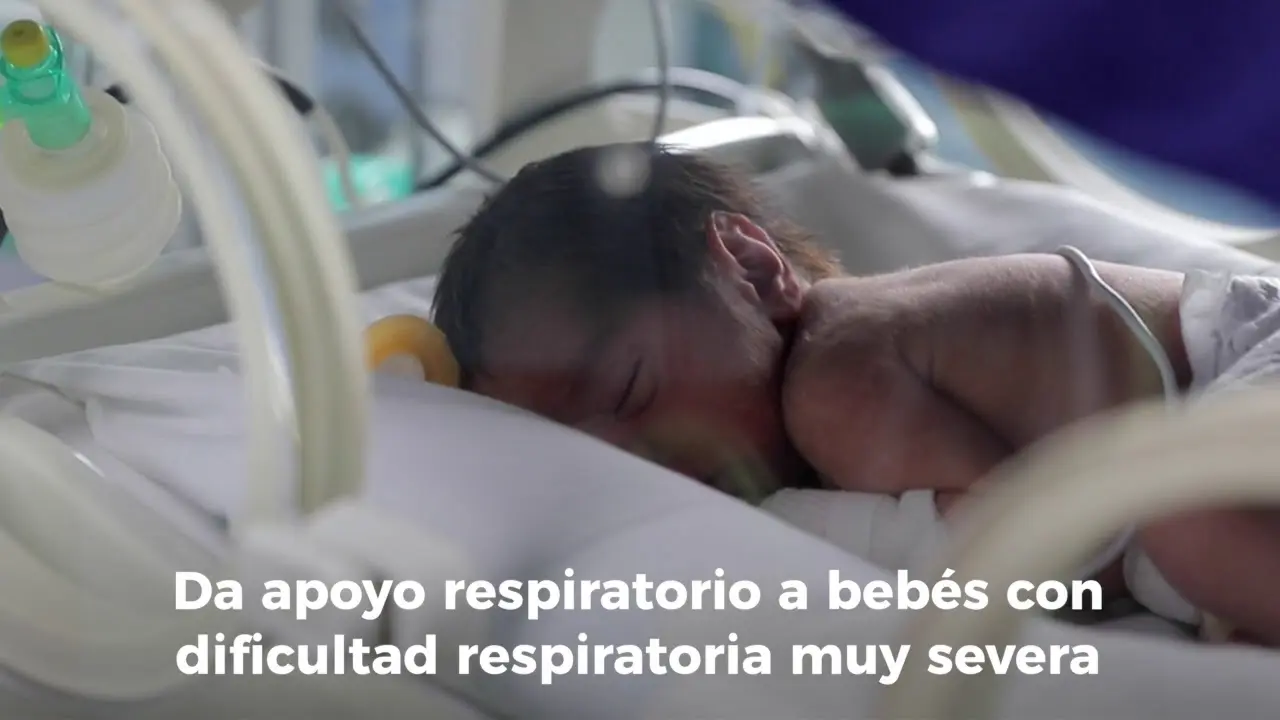 Ventilación de Alta Frecuencia Oscilatoria (VAFO) en Pediatría - Qué es la PMVA bafo ventilador - Qué es la PMVA