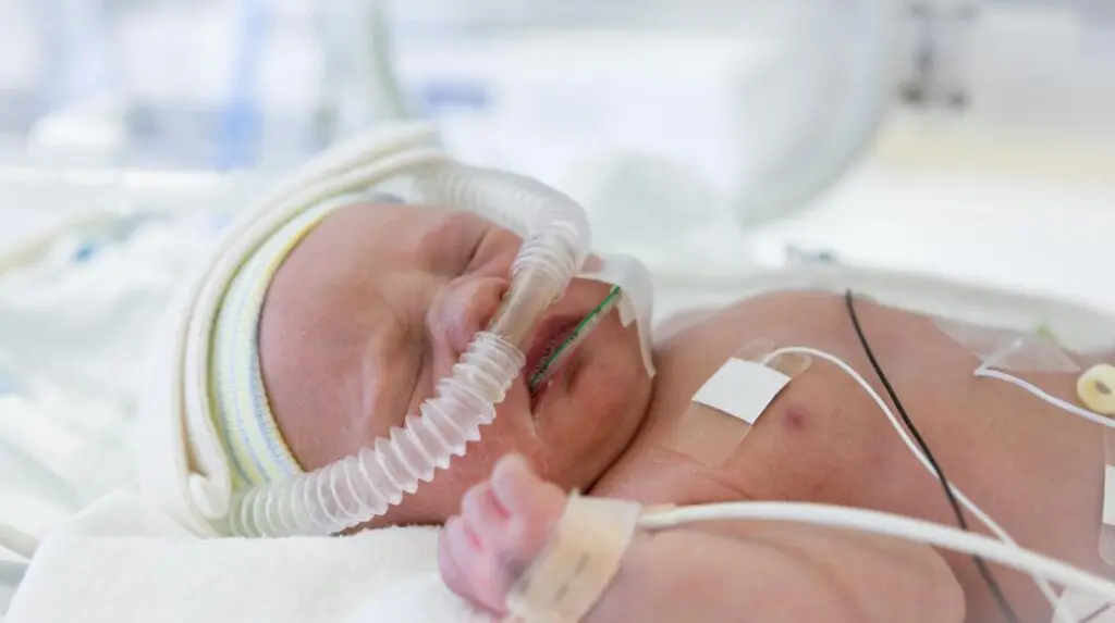 ventilación nasal a presión positiva intermitente - Qué es la ventilacion con presión positiva intermitente