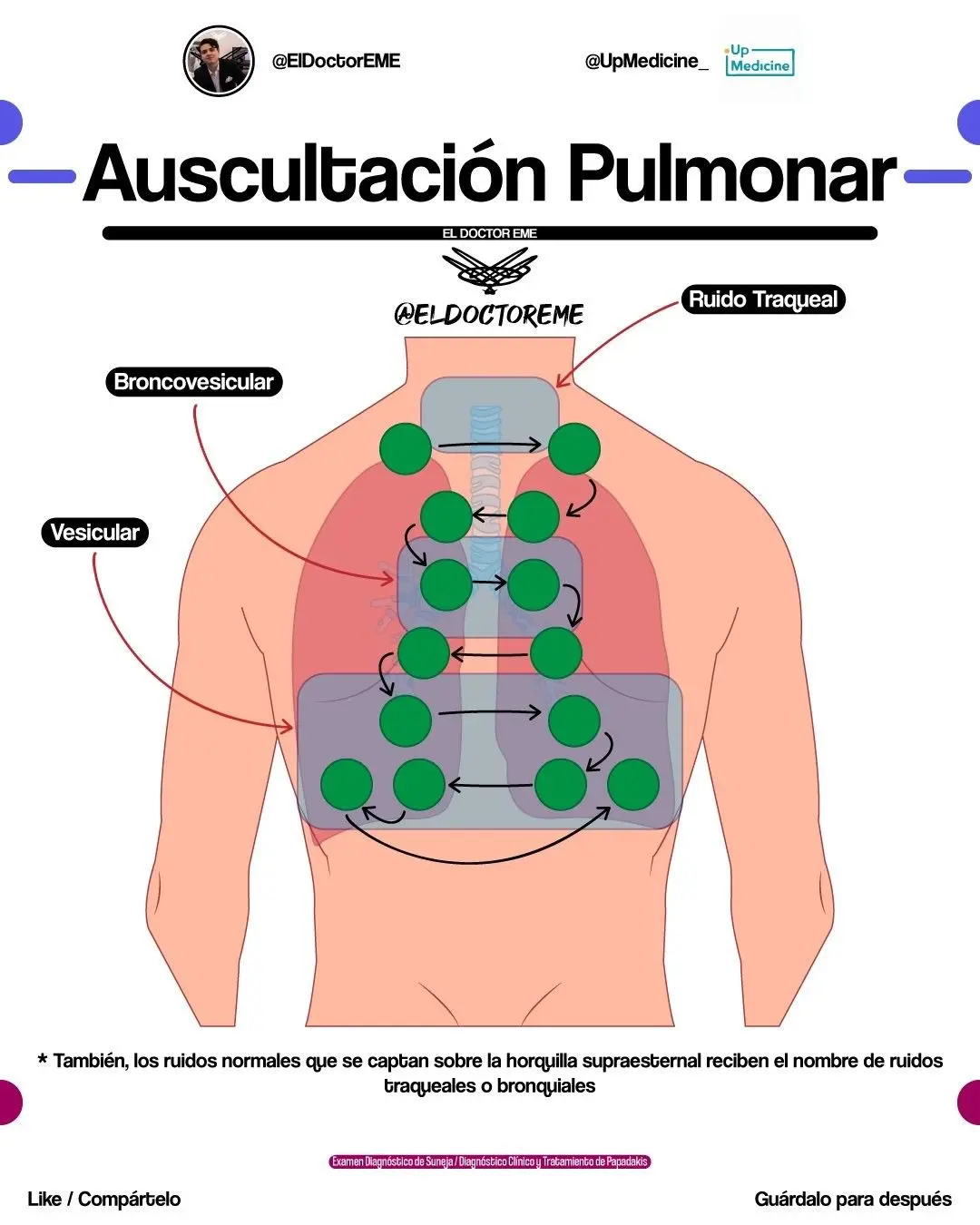Campos Pulmonares Ventilados: Abreviatura y Significado - Qué es MV en medicina campos pulmonares ventilados abreviatura - Qué es MV en medicina