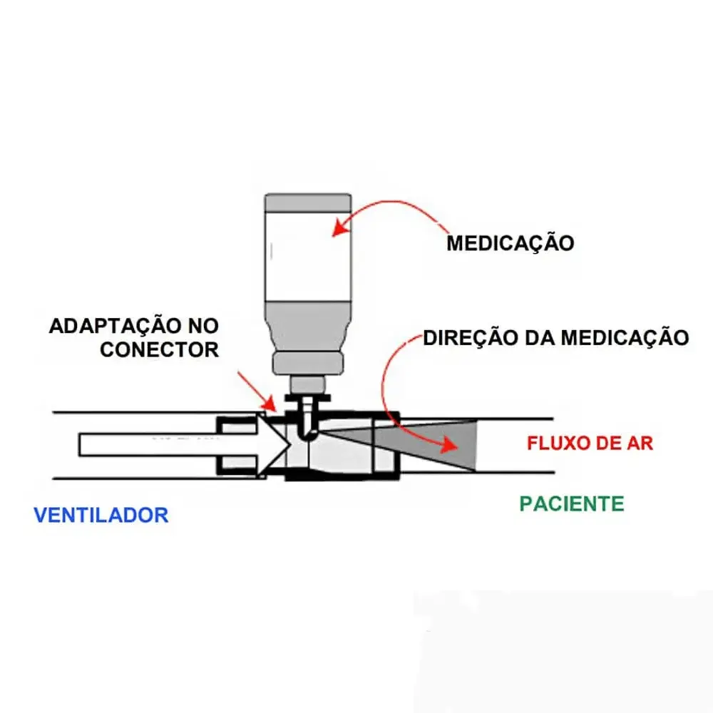 Dispositivo MDI Ventilador Mecánico: Componentes Internos y Funcionamiento - Qué es un dispositivo MDI dispositivo mdi ventilador mecánico - Qué es un dispositivo MDI