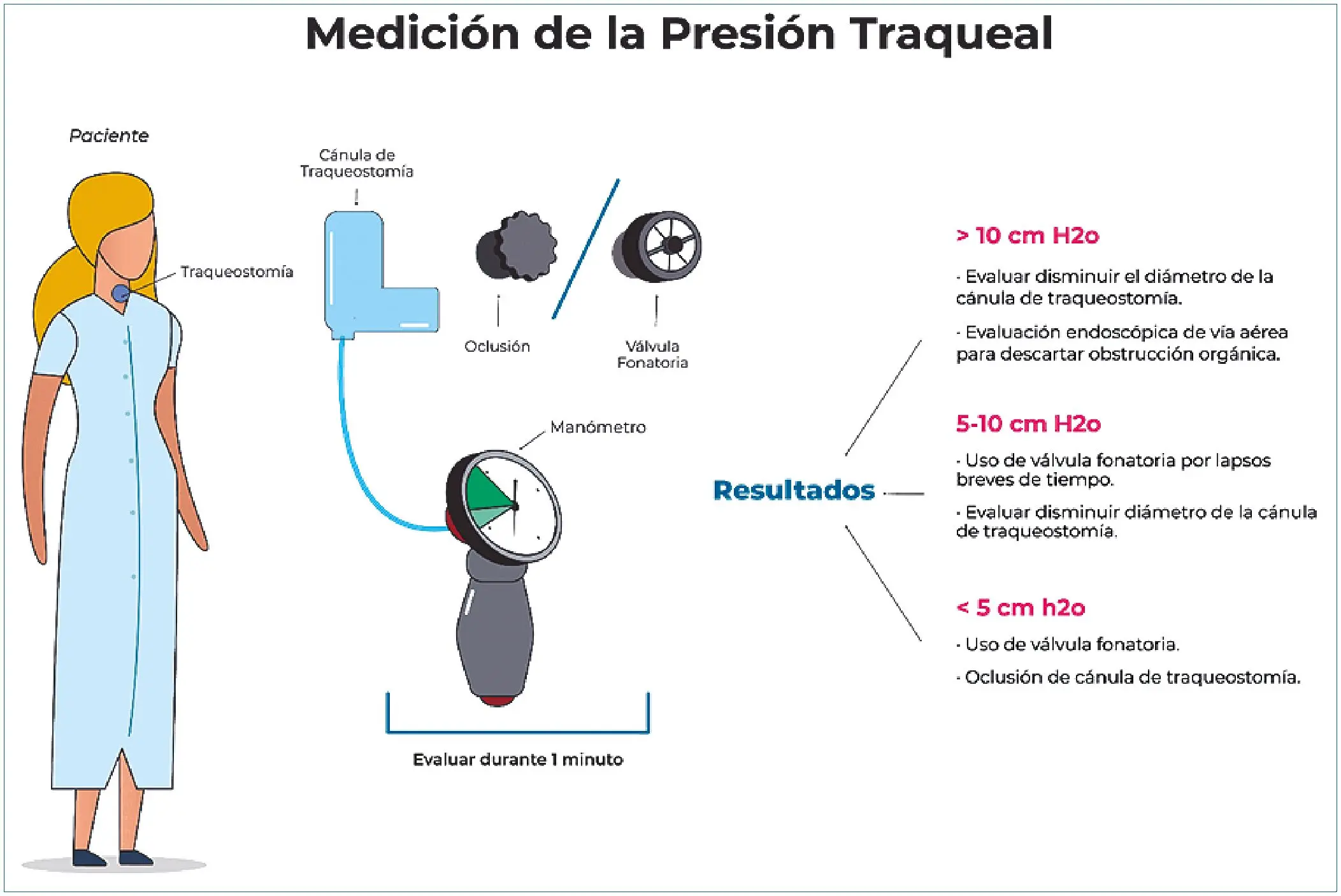 Escape de Ventilador Traqueostomía: Causas, Síntomas y Manejo - Qué ocurre cuando la cánula de traqueostomía se expulsa accidentalmente escape de ventilador traqueostomia - Qué ocurre cuando la cánula de traqueostomía se expulsa accidentalmente
