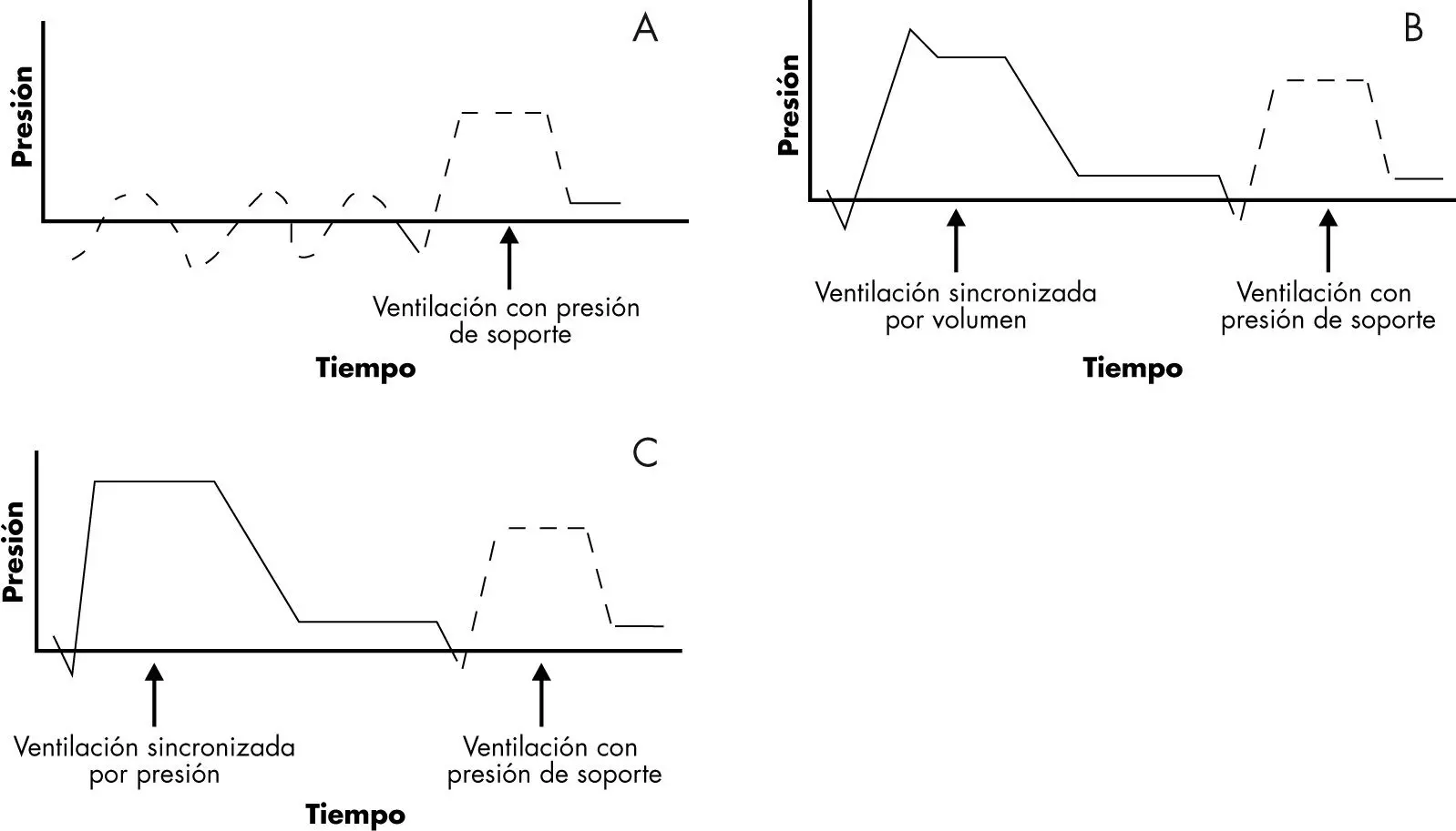 Ventilador Mecánico Trilogy: Guía Completa - Qué significa PEEP en ventilador mecánico ventilador mecanico trilogy - Qué significa PEEP en ventilador mecánico