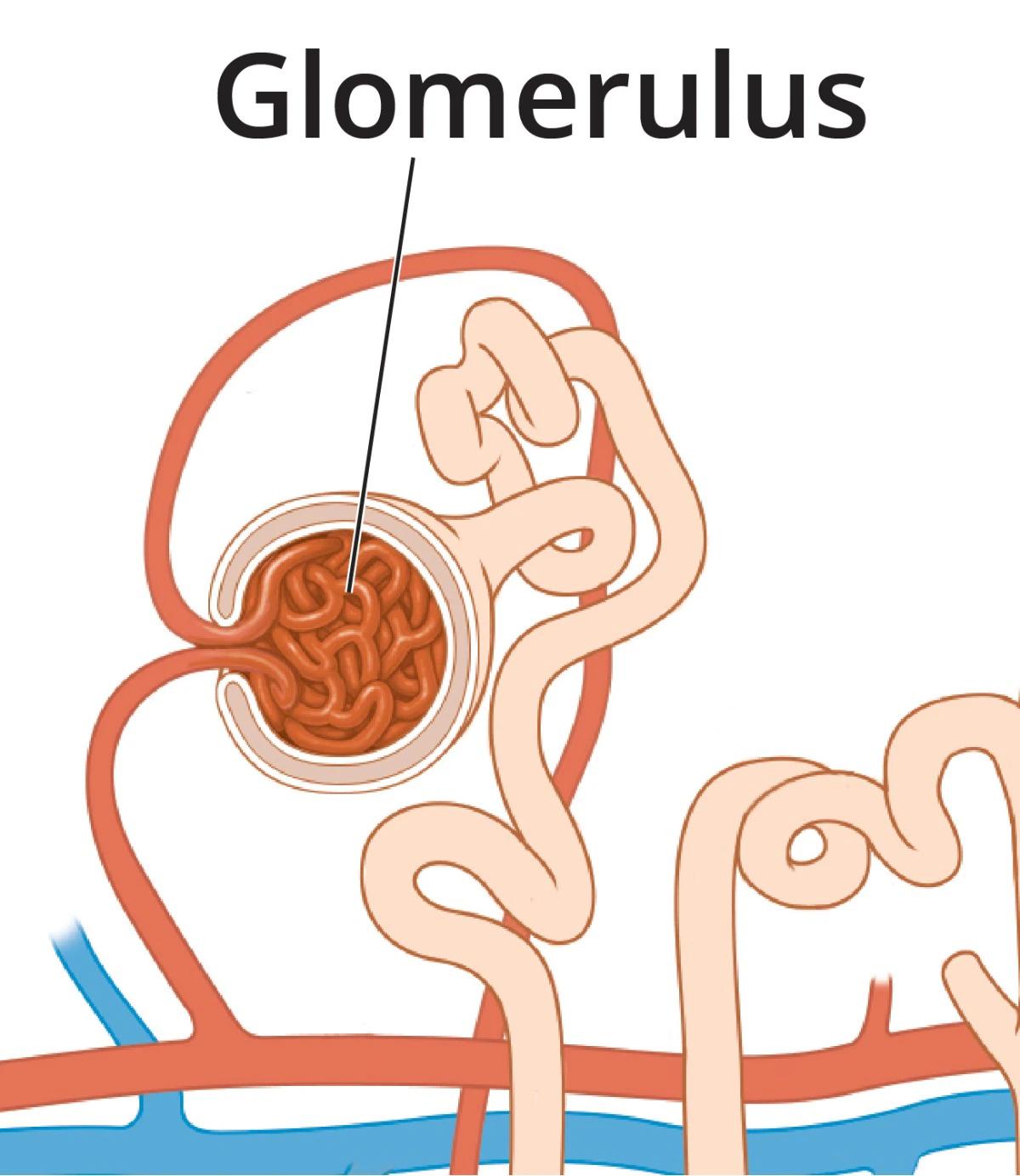 La Hematuria Glomerular y su Impacto en la Ventilación Espontánea - Qué sucede si sufre daño glomerular la hematuria glomerular puede alterar la ventilación espóntanea - Qué sucede si sufre daño glomerular