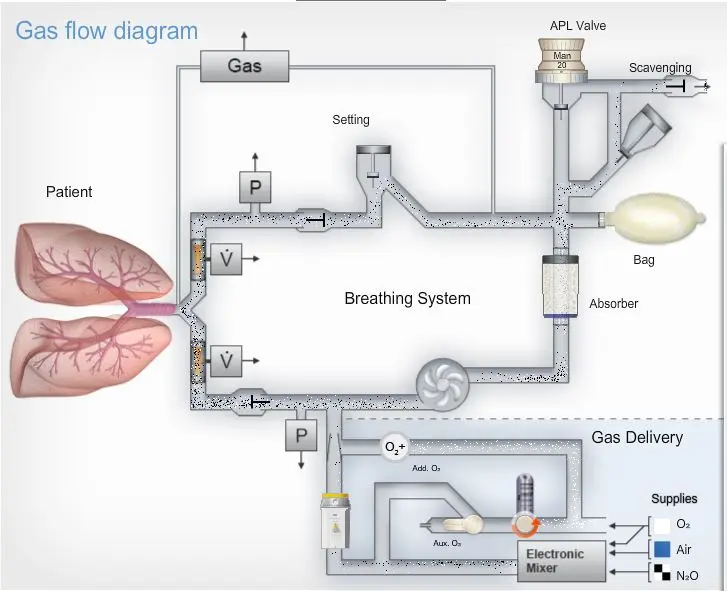 Tres Tipos de Ventilación en Anestesia: General, Regional y Local - What are the different types of anesthesia ventilators three kinds ventilation anesthesia - What are the different types of anesthesia ventilators