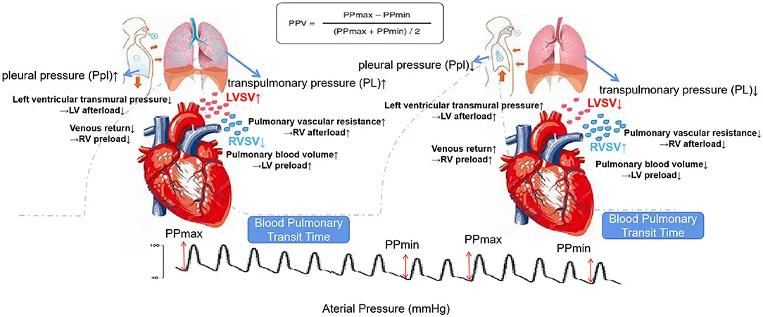 Variación de la Presión del Pulso Arterial con Ventilación Mecánica - What are the limitations of pulse pressure variation arterial pulse pressure variation with mechanical ventilation - What are the limitations of pulse pressure variation