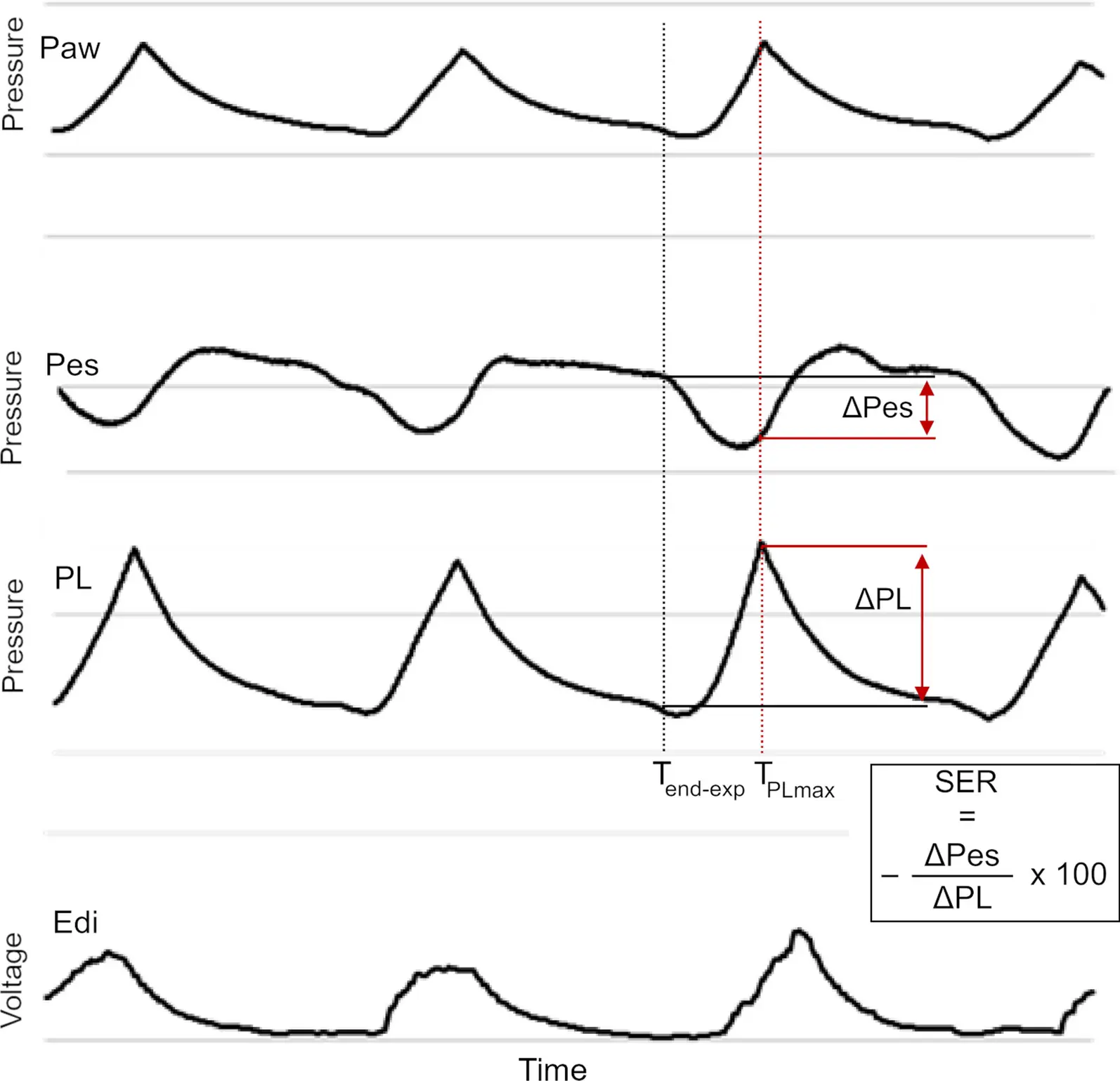 the influence of high positive end-expiratory pressure ventilation - What are the outcomes of positive end expiratory pressure