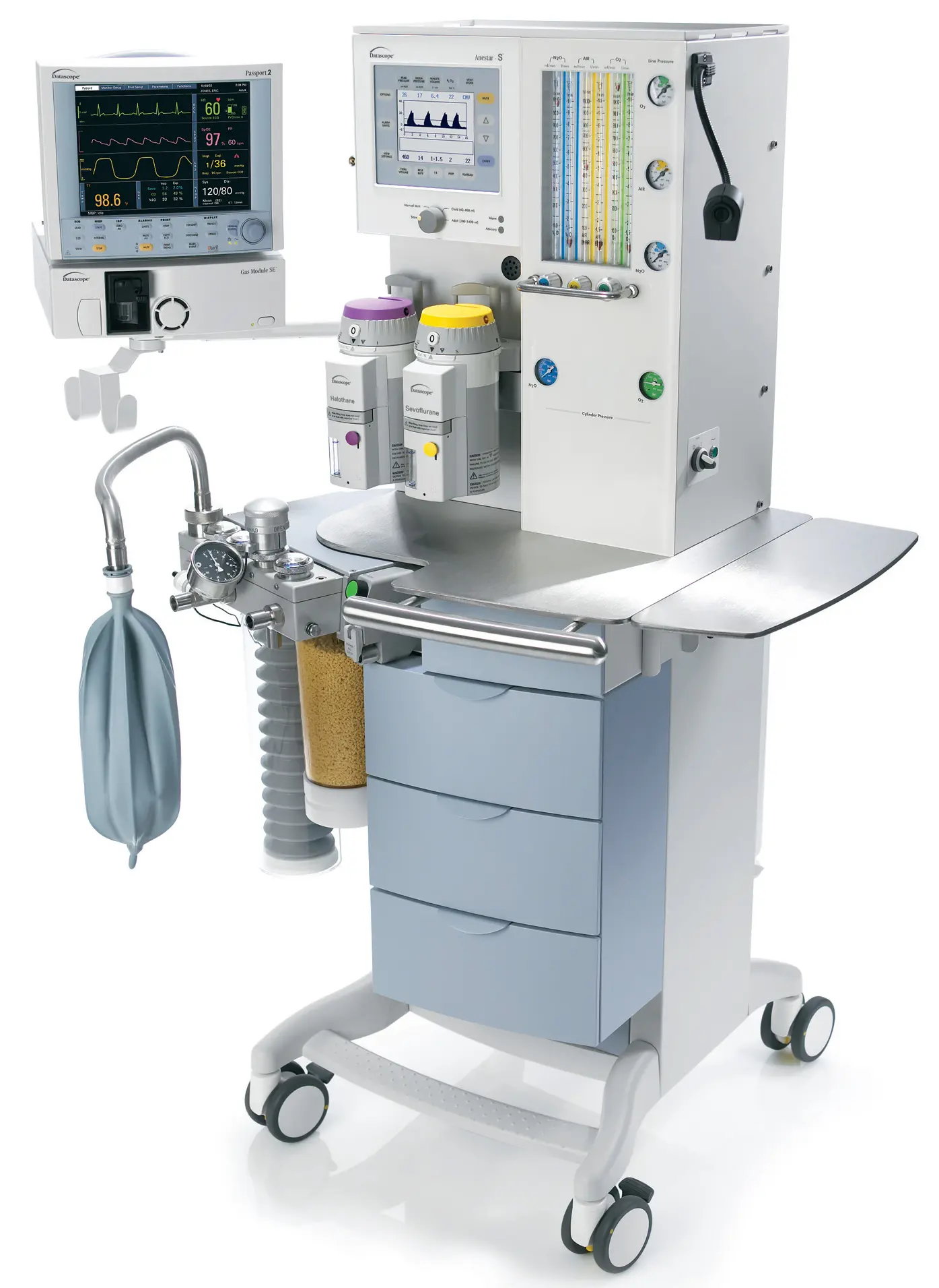 Tres Tipos de Ventilación en Anestesia: General, Regional y Local - What are the three types of anesthesia three kinds ventilation anesthesia - What are the three types of anesthesia