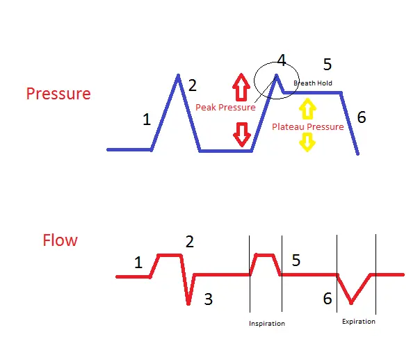 Efectos de la Presión Plateau Alta en Ventilación Mecánica - What does an increase in plateau pressure indicate efect of high plateau pressure ventilator - What does an increase in plateau pressure indicate
