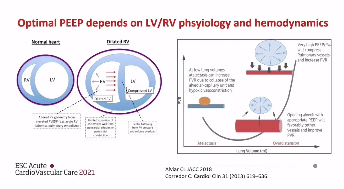 Interacción Corazón-Pulmón en la Ventilación Mecánica: Hemodinámica y Presión Transmural - What is a transmural pressure heart heart lung interaction in mechanical ventilation his hemodynamics redaliyc - What is a transmural pressure heart
