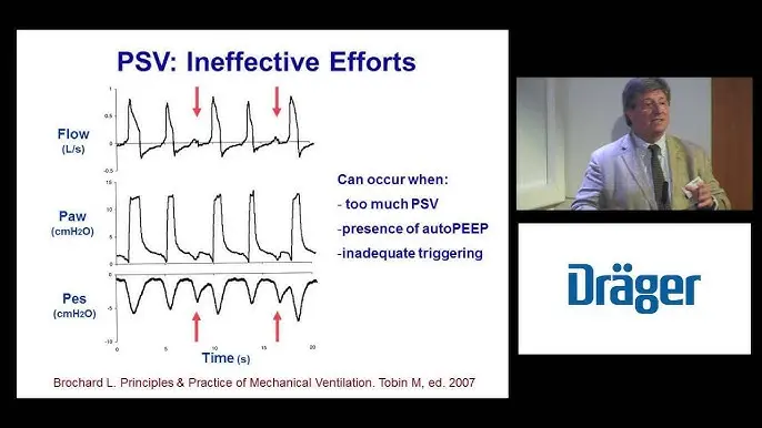 Ventilación Mecánica Asincrónica: Causas, Consecuencias y Manejo - What is asynchronous breathing asynchrony mechanical ventilation - What is asynchronous breathing