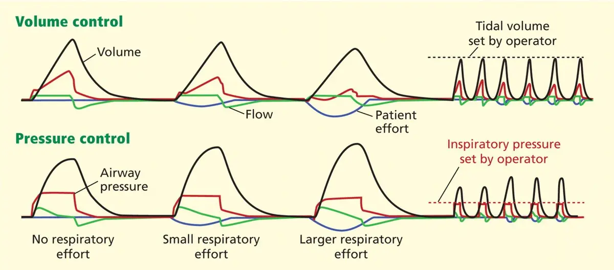 Ventilación Controlada vs. Ventilación Espontánea: Una Guía Completa - What is the difference between spontaneous and controlled ventilation controlled ventilation - What is the difference between spontaneous and controlled ventilation