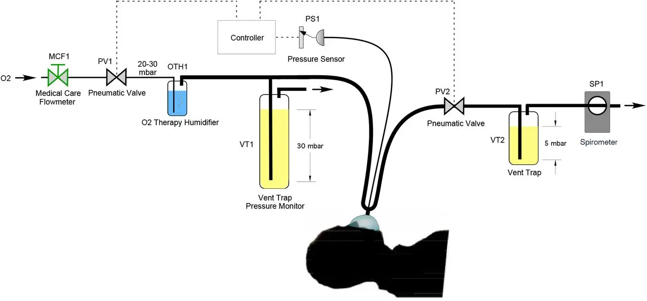 FluidSIM Mechanical Ventilator: Una Guía Completa para la Ventilación Mecánica - What is tinsp on a ventilator fluidsim mechanical ventilator - What is tinsp on a ventilator