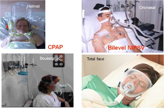 propofol non invasive mechanical ventilation - What sedative is used for non-invasive ventilation