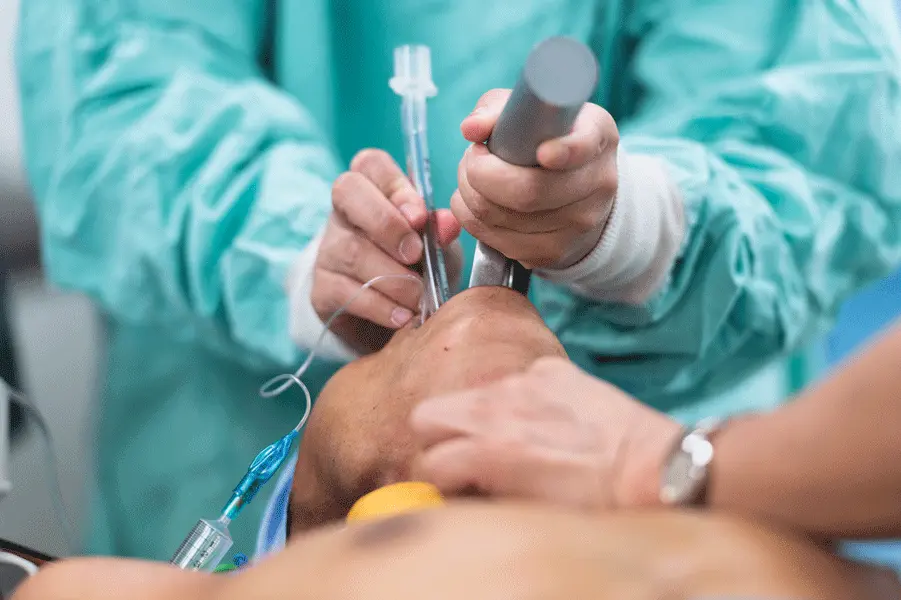 El Paciente Ventilado en Deterioro: Un Enfoque Integral - Why do patients crash after intubation the crashing ventilated patient - Why do patients crash after intubation